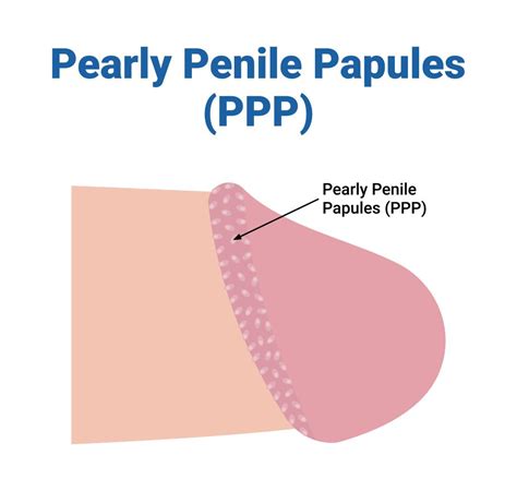 penice|Penis